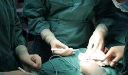 北京阴茎延长术视频,技术革新与术后恢复全解析