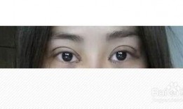 切开双眼皮视频